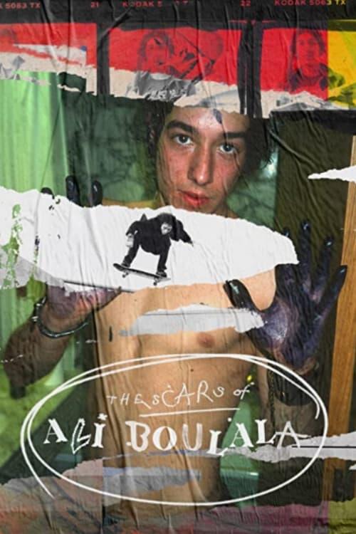 The Scars of Ali Boulala